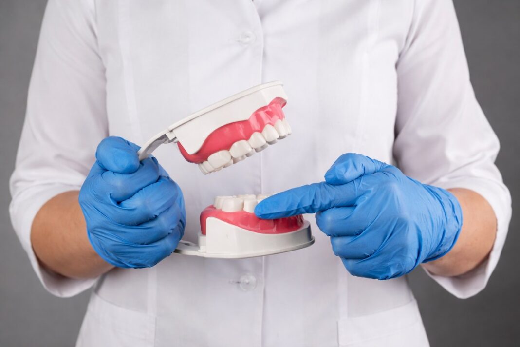 does removing wisdom teeth change face shape